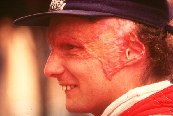 getty_laudaniki19760931